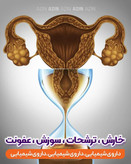 شیاف تنگ کننده واژن اصل و سوپر شیاف
