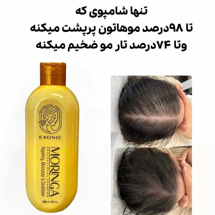 شامپو ضدریزش مو مورینگا بیز صددرصد اصلی
